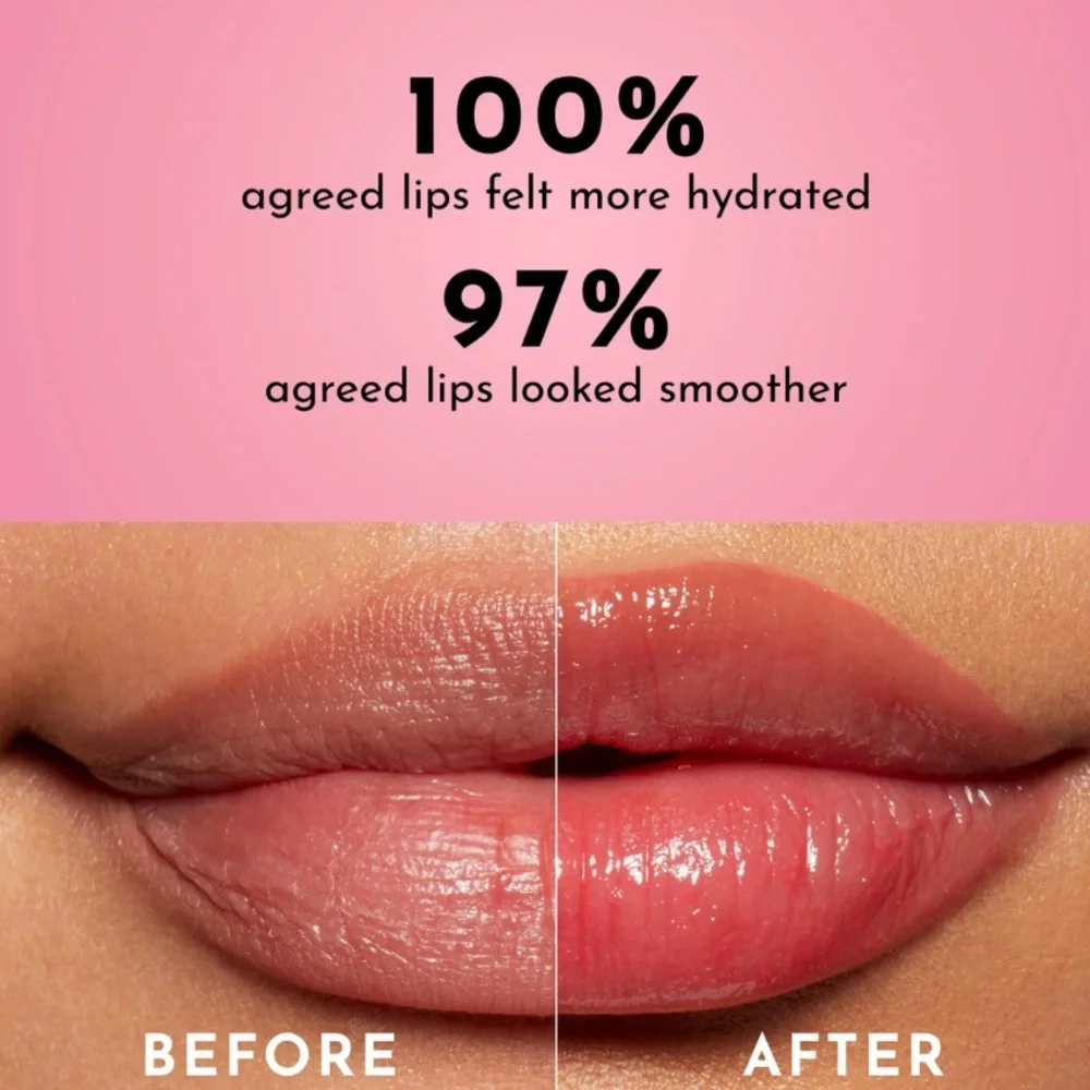 Fresh Sugar Rose Lip Treatment